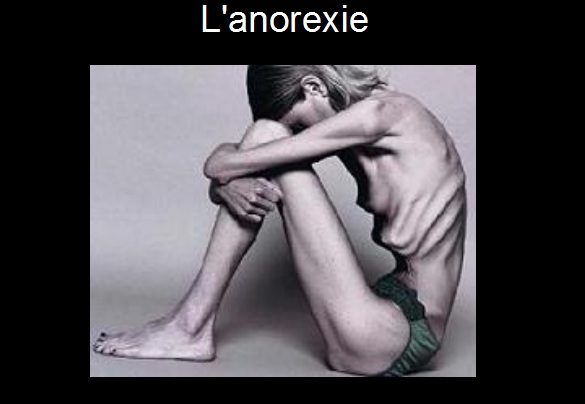 site rencontre anorexique