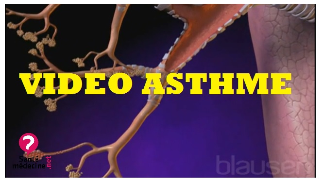 vidéo asthme