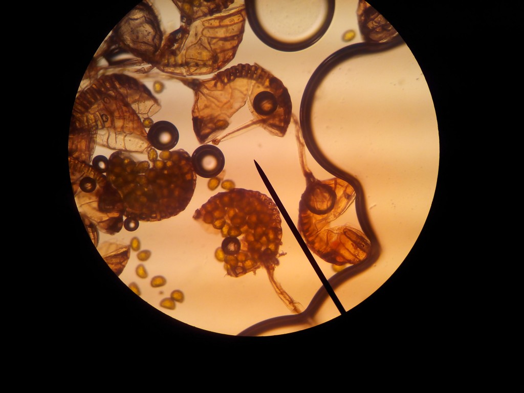 Observation de spores et sporanges de fougères SVT (5) Vive les SVT ! Les sciences de la vie Observation de spores et sporanges de fougères SVT (5) Vive les SVT ! Les sciences de la vie
