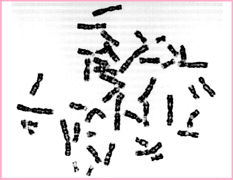 caryotype-svt-vrac