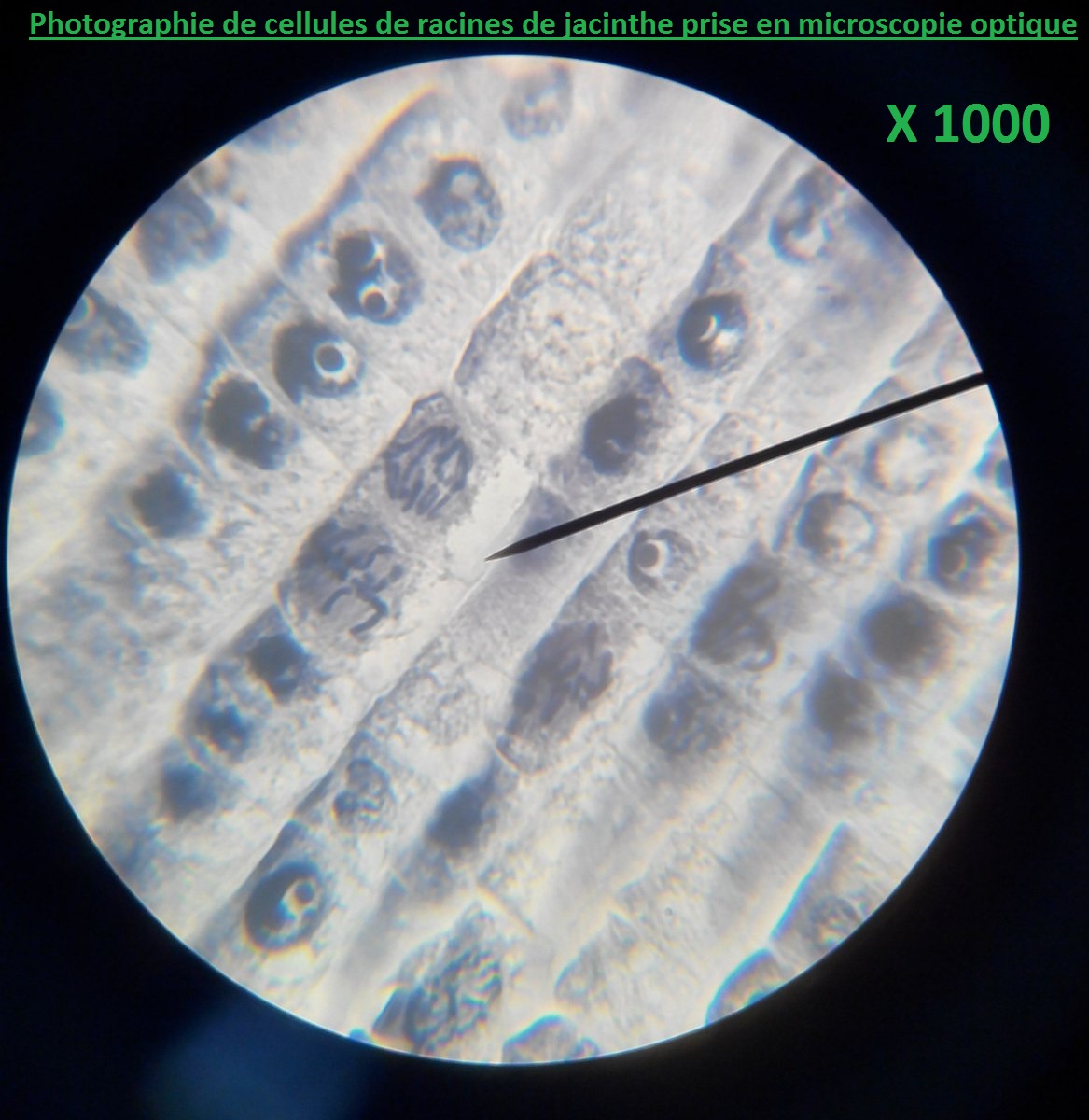 cellules de racines de jacinthes chromosomes SVT mitose microscope