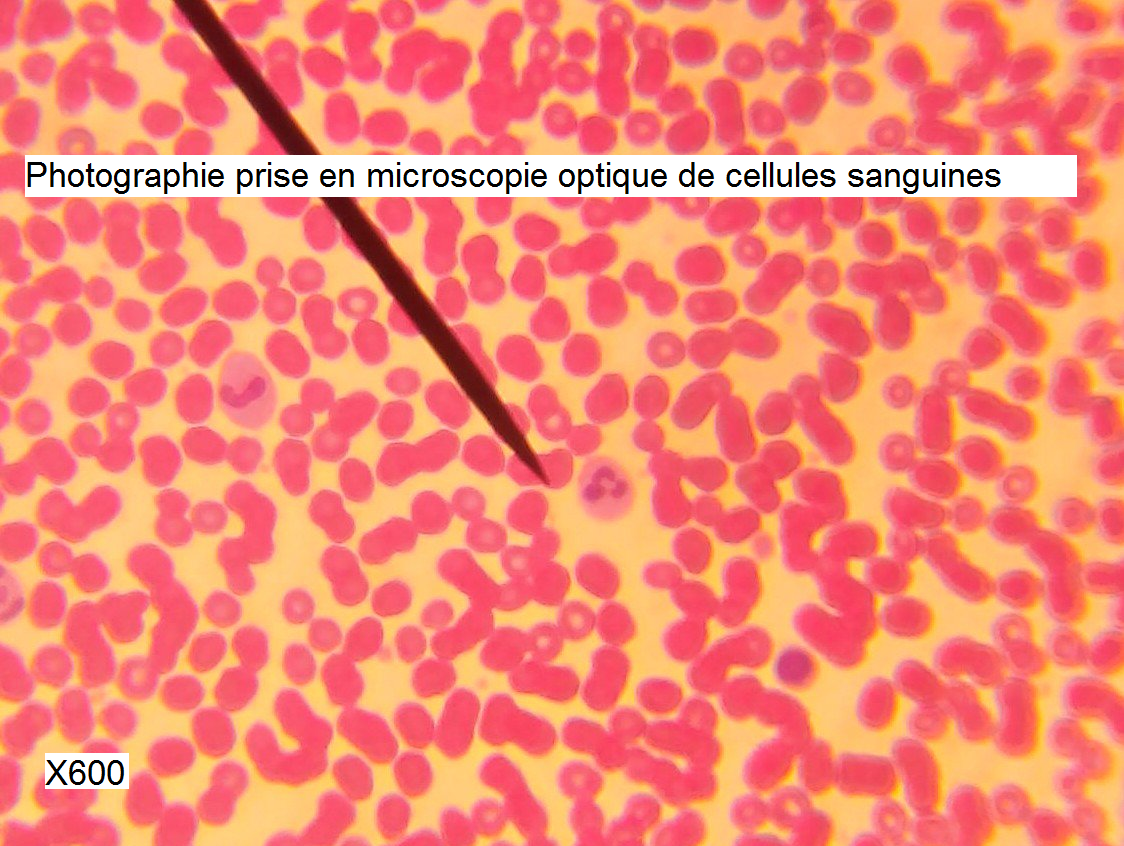 photographie prise en microscopie optique cellules sanguines svt