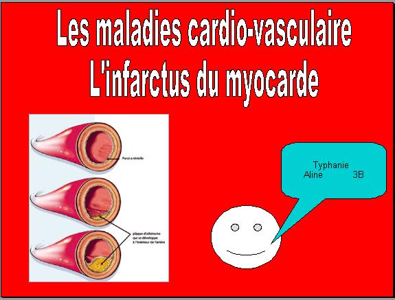 maladie-cardiovasculaire1