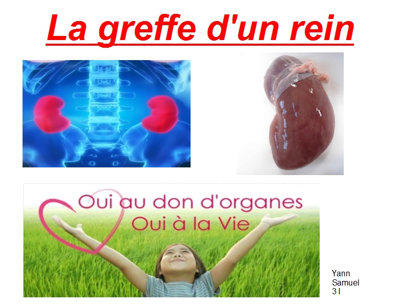 La greffe de rein