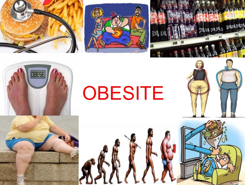 L’obésité