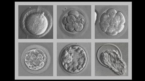 Fécondation In Vitro : Robert Edwards, prix Nobel de médecine