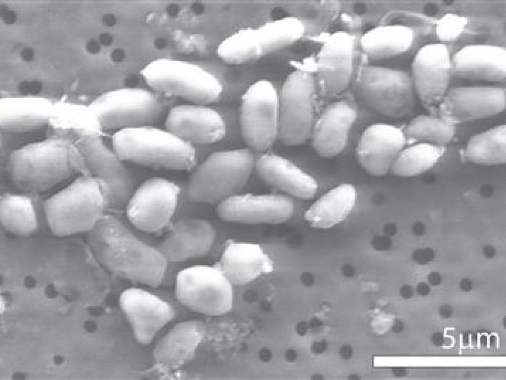 Des bactéries se nourrissent d’arsenic