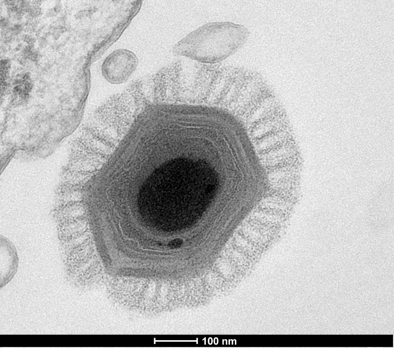 Megavirus chilensis, le plus gros des virus géants connus