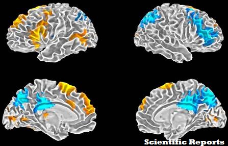 Chaque cerveau est unique