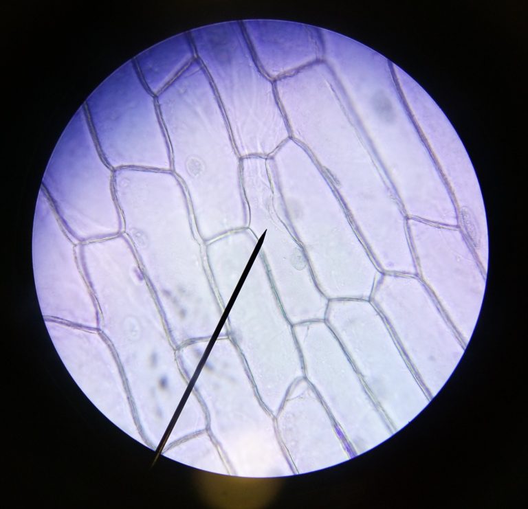 cellules-observ-es-au-microscope-svt-noyau-cytoplasme-membrane